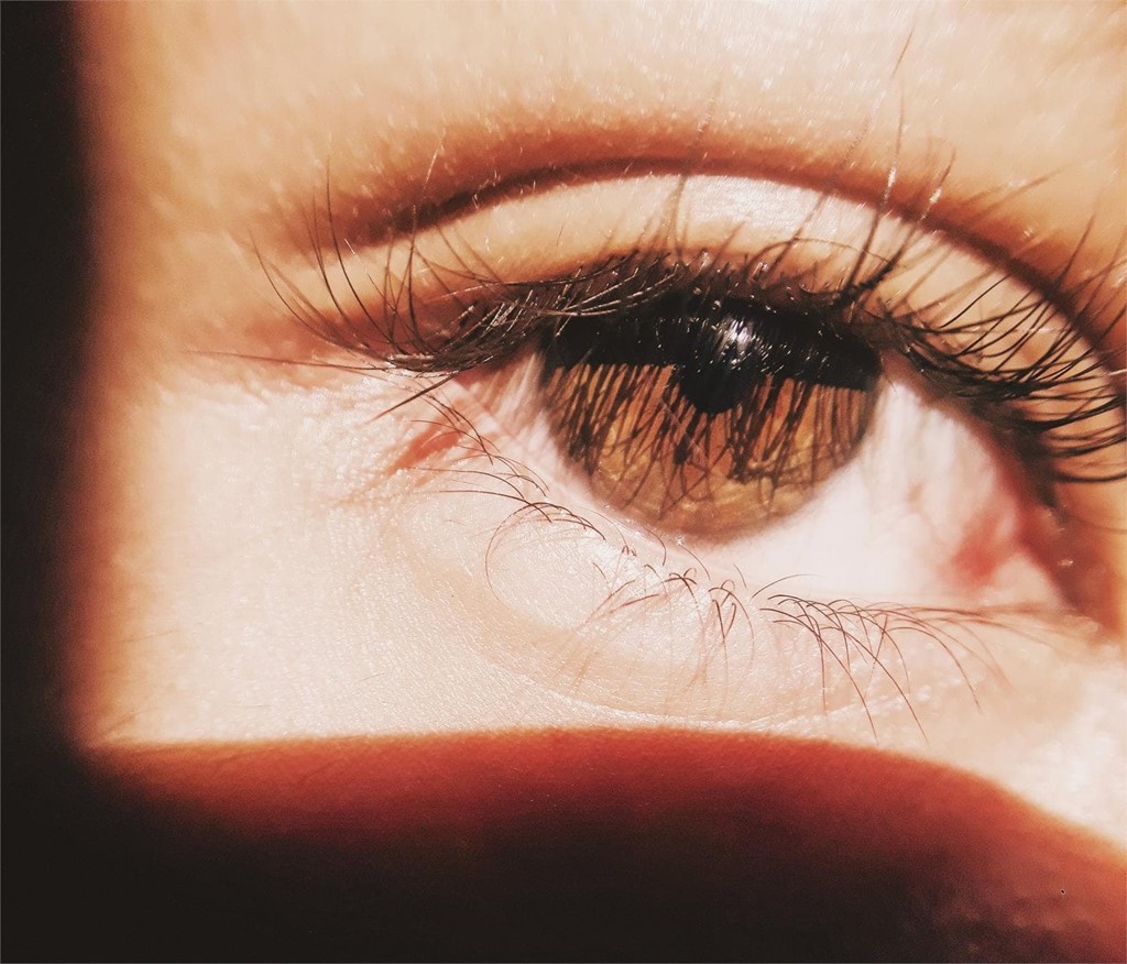 Beneficios de la blefaroplastia