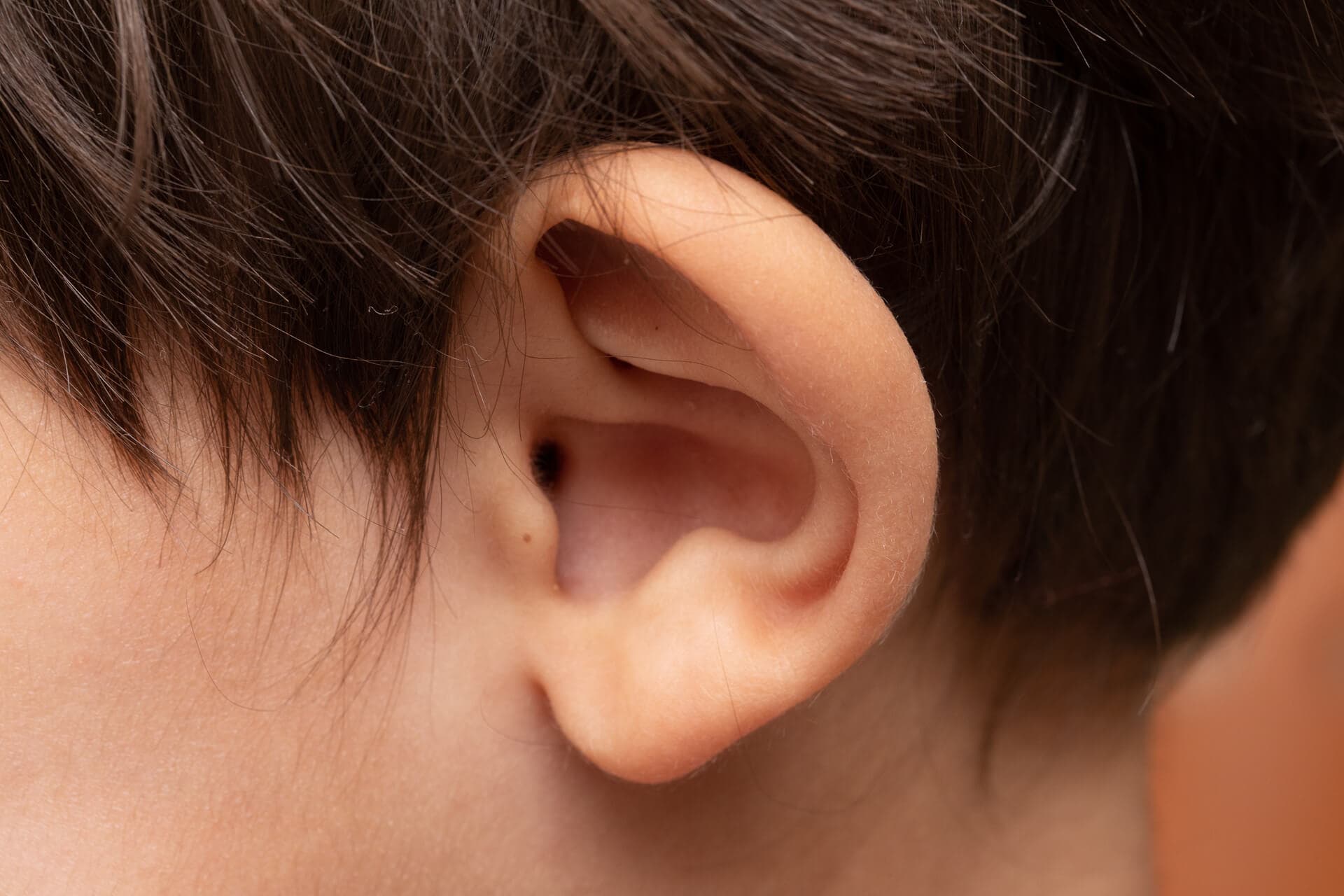 ¿Está pensando en realizarse una otoplastia?