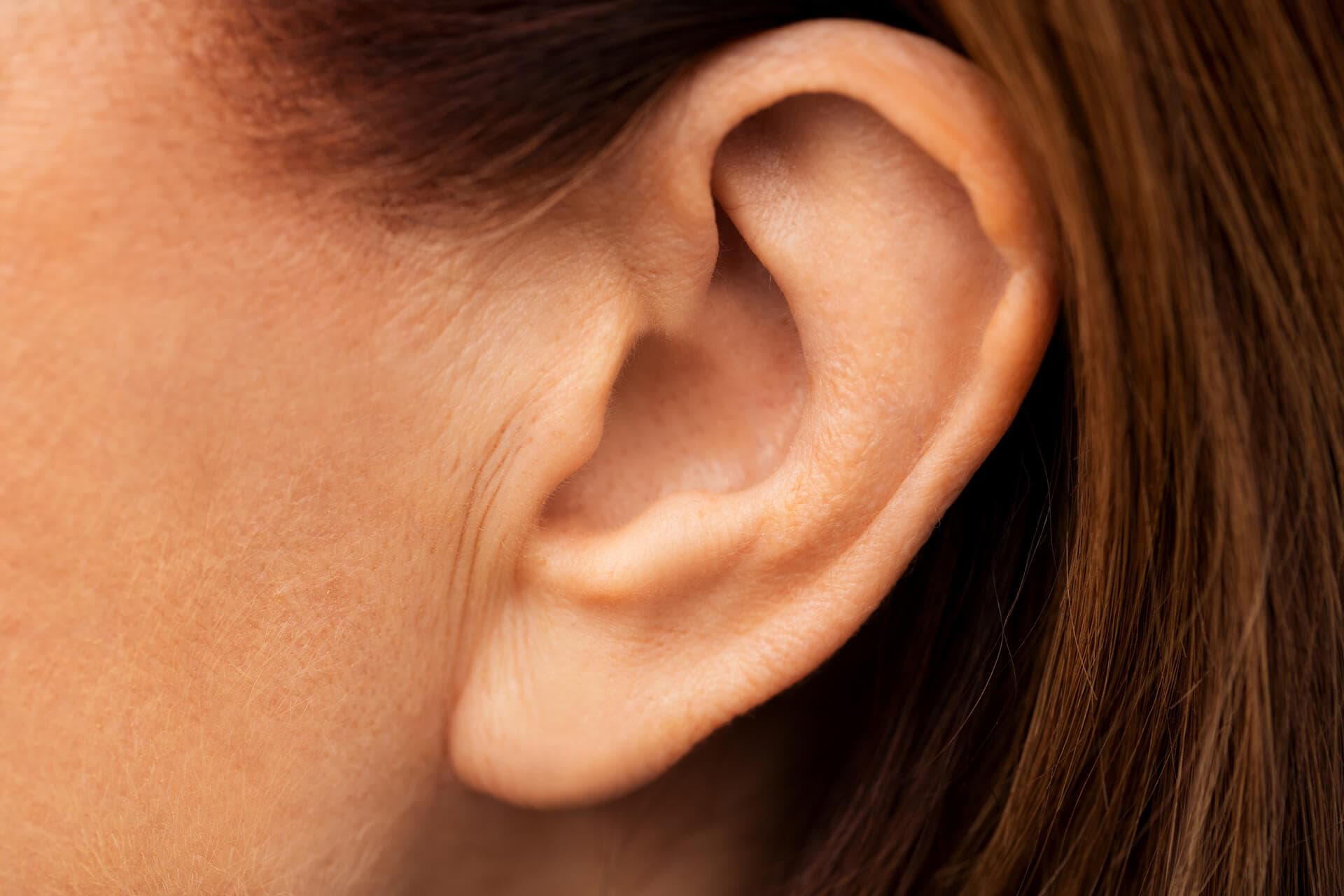 Preguntas frecuentes sobre la otoplastia
