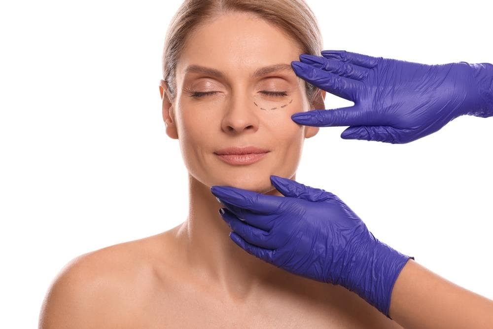 ¿La blefaroplastia afecta de alguna forma a los problemas de visión? 