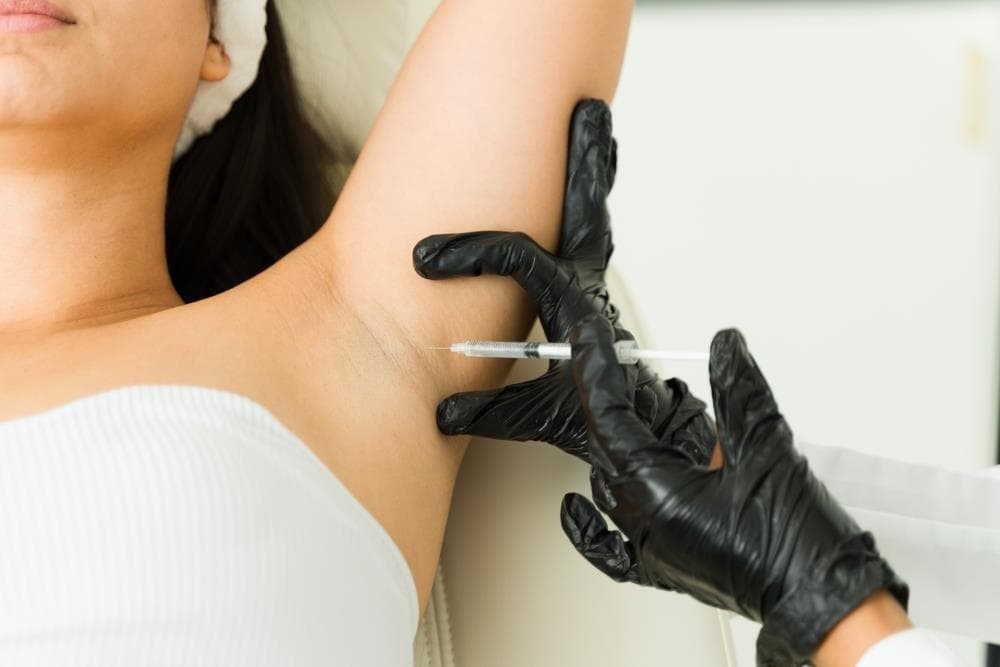 Otras aplicaciones de bótox: la hiperhidrosis