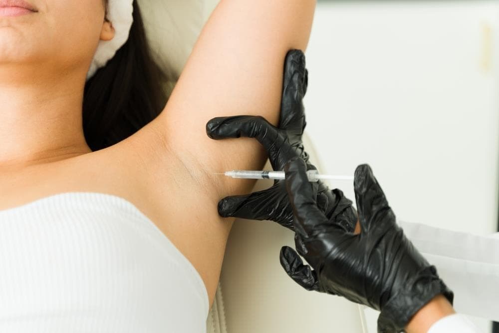 Otras aplicaciones de los neuromoduladores: la hiperhidrosis