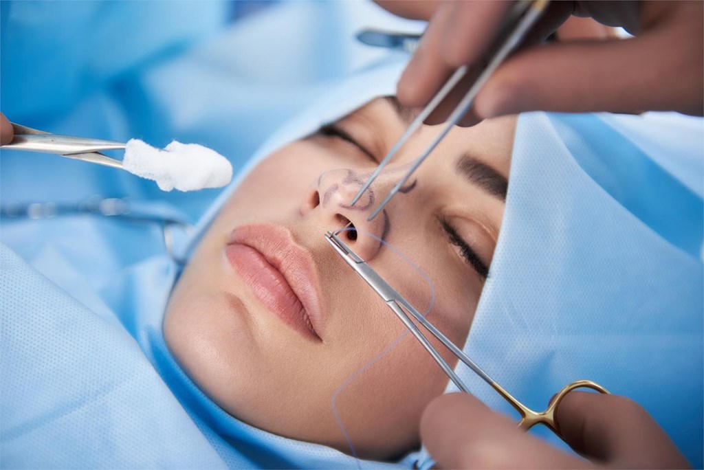 ¿Qué esperar durante la recuperación de una rinoplastia?