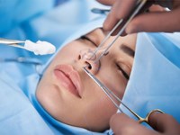 ¿Qué esperar durante la recuperación de una rinoplastia?