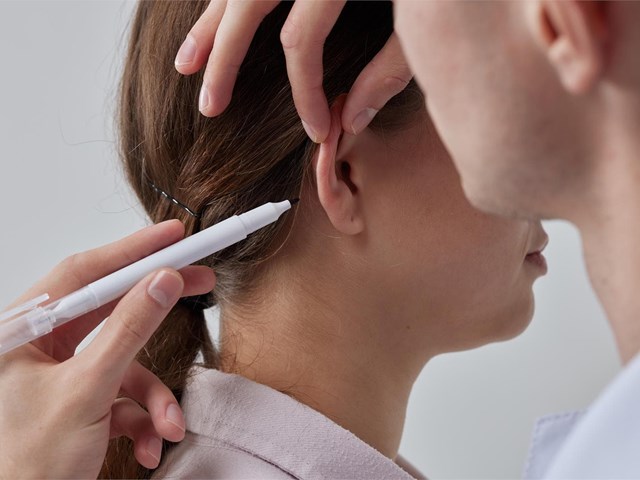 Recuperación después de una otoplastia: 5 consejos prácticos